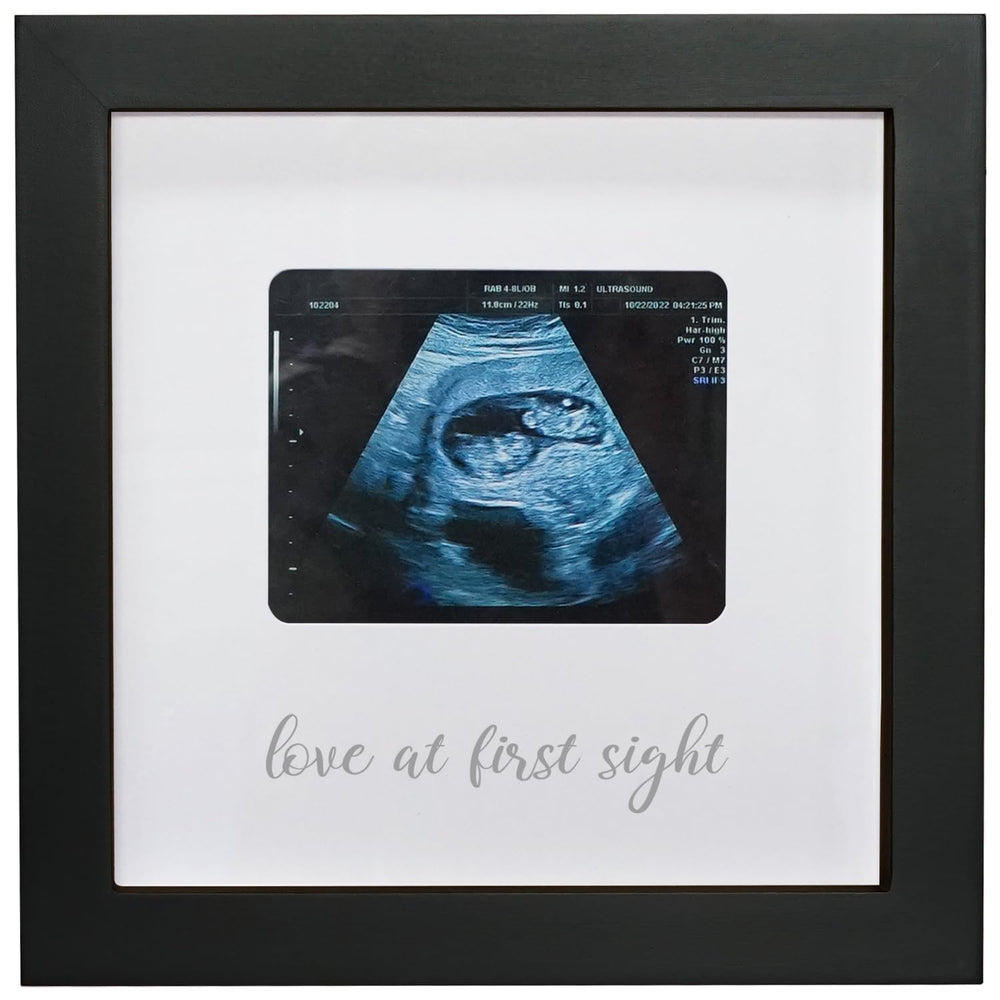 HAMUIERS Love at First Sight frame front-view shows a black wooden ultrasound keepsake.