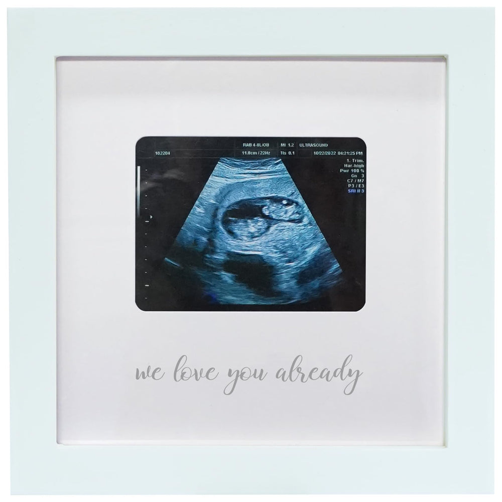 HAMUIERS sonogram picture frame in a nursery decor setting highlights cherished memories.