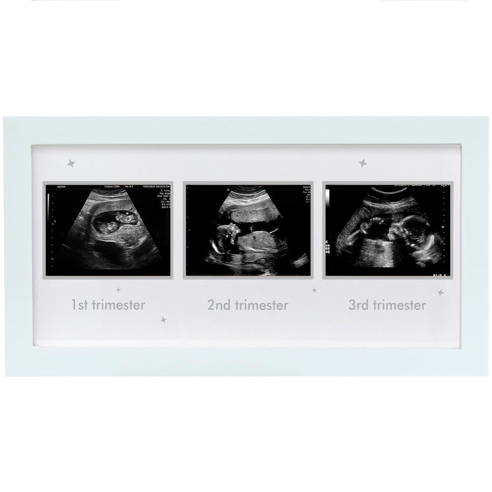 HAMUIERS Ultrasound Frame front view in a bright nursery emphasizing easy memory display.
