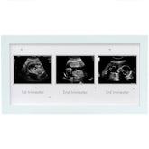 HAMUIERS Ultrasound Frame front view in a bright nursery emphasizing easy memory display.