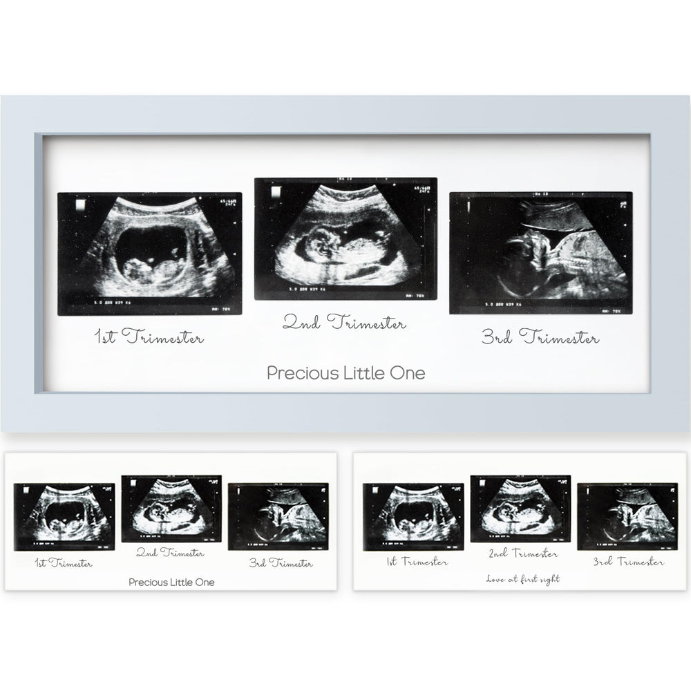 KeaBabies Trio Ultrasound Frame front view in Mist Blue elevates modern nursery decor.