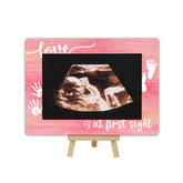 OXRUN New Mom Gifts frame showcases ultrasound image for a heartfelt memory display.