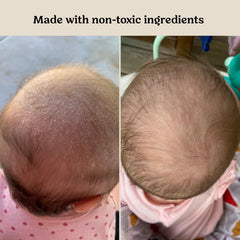 Roe Wellness oil application shows massage-friendly texture for calm skin