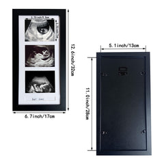trlry triple ultrasound frame plexiglass front protects photos while staying clear