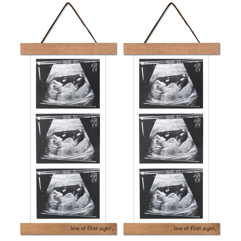 Zyeco sonogram frame on fridge displays ultrasound photos for cherished memories