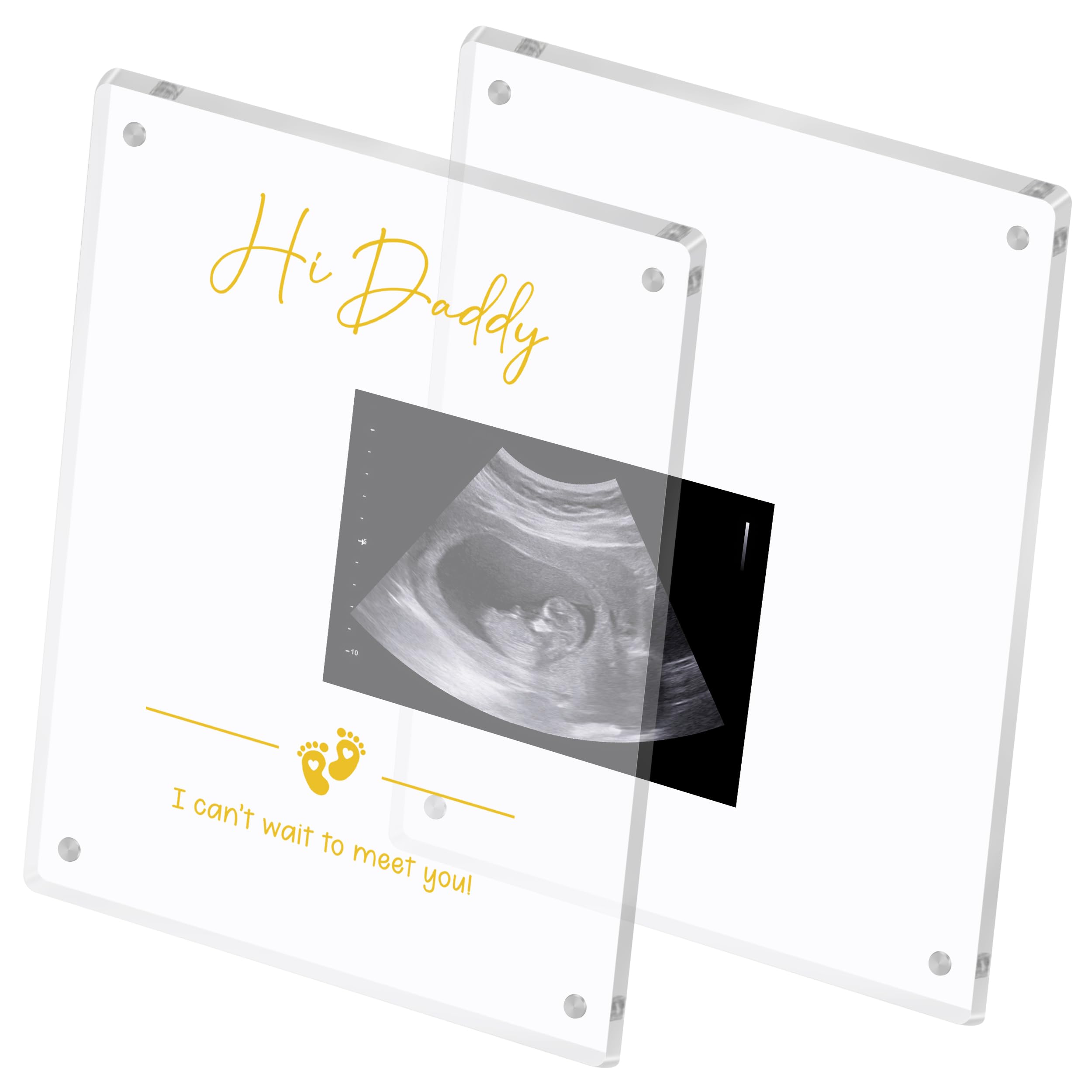 Blinking Stars ultrasound frame close-up shows gold Hi Daddy text enhancing nursery decor