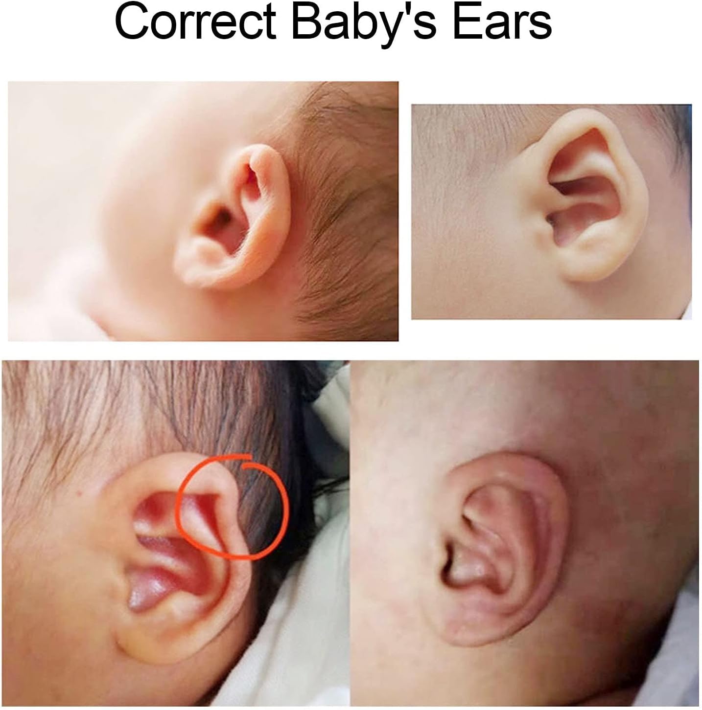 Brrnoo auricle-correction-patch-application-steps image illustrating infant-ear use