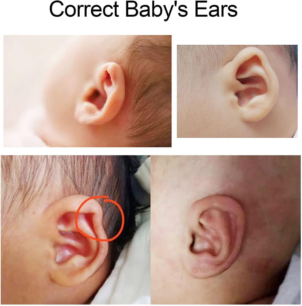 Brrnoo auricle-correction-patch-application-steps image illustrating infant-ear use