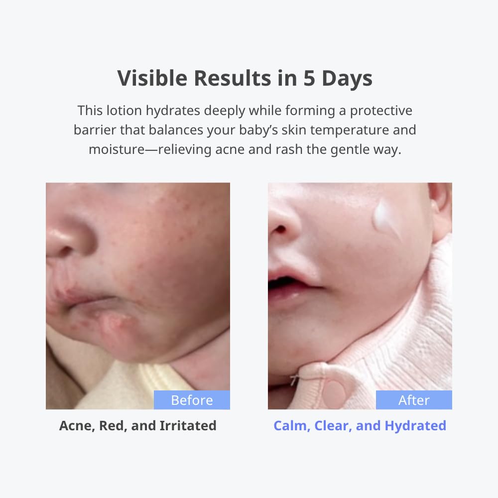 CHA&MOM texture closeup demonstrates non-sticky, fast-absorbing formula for easy dressing