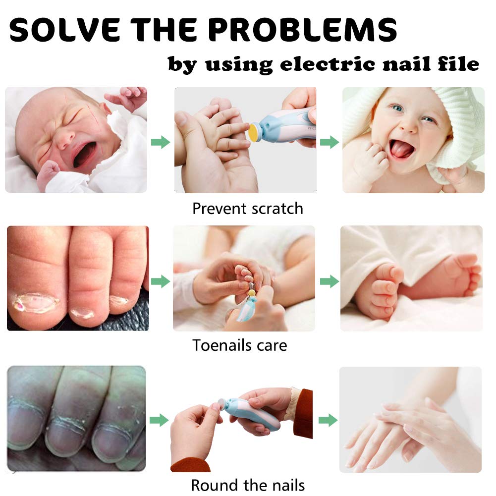 Consevisen baby nail trimmer comes with a carry case for convenient storage.