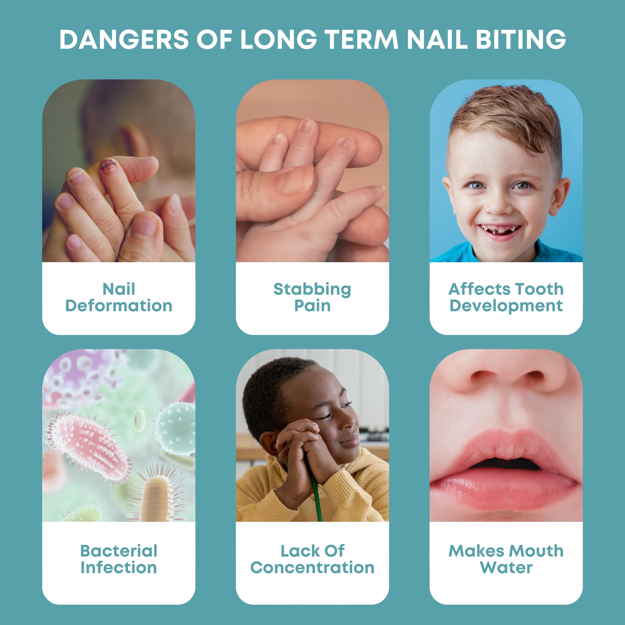 Control-It kid-safe deterrent pack ideal for families.