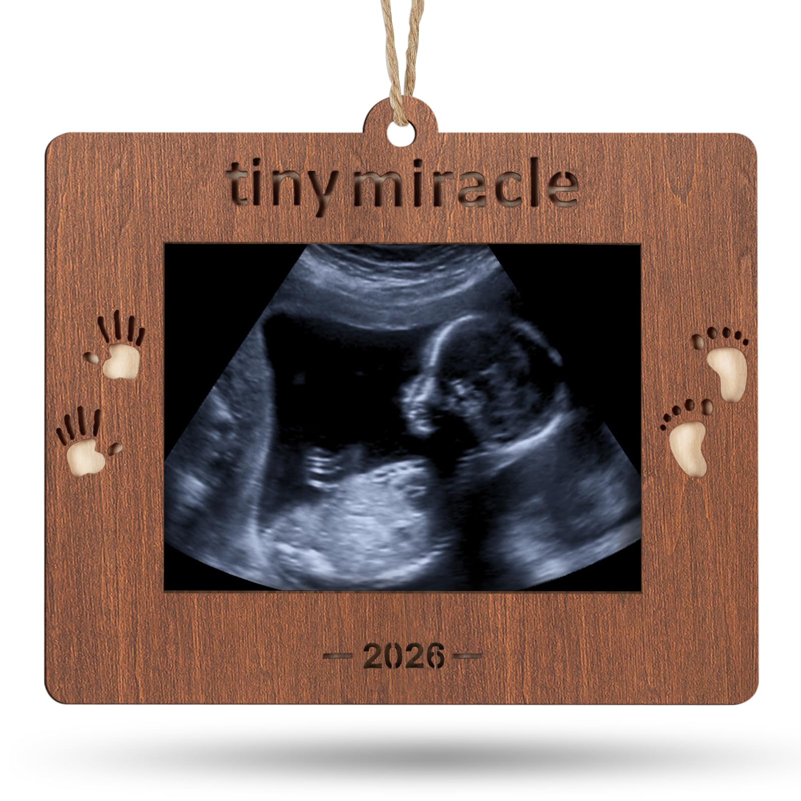 Creawoo 2026 Tiny Miracle frame front view highlighting a keepsake ultrasound memory