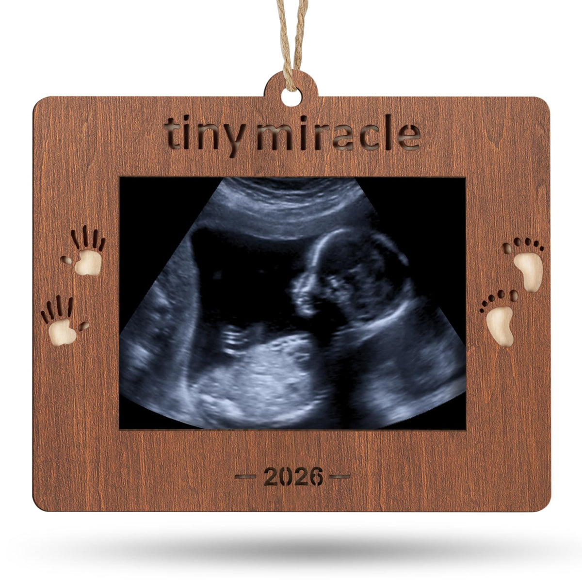 Creawoo 2026 Tiny Miracle frame front view highlighting a keepsake ultrasound memory