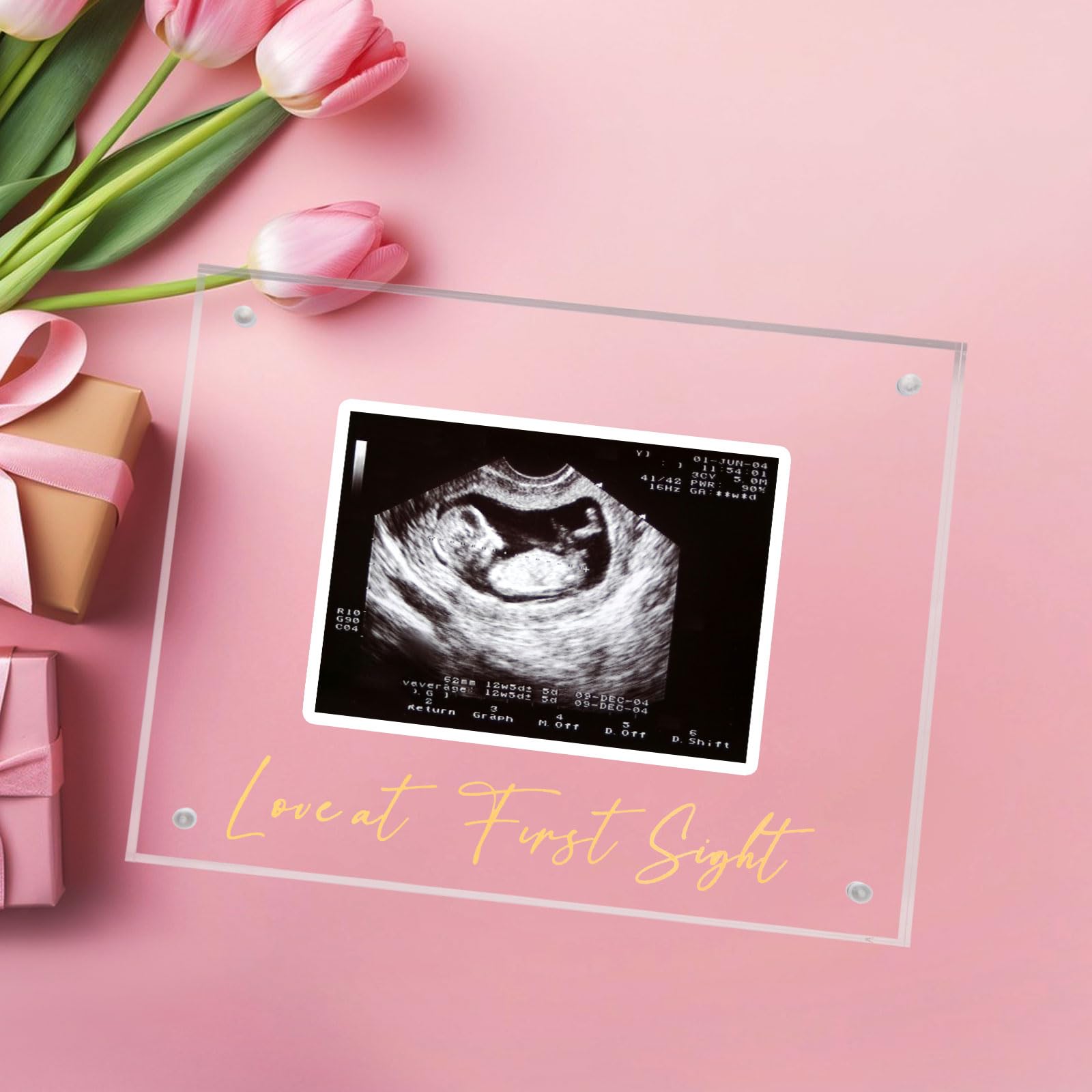 DEYIXUN ultrasound frame gift packaging makes a thoughtful maternity keepsake