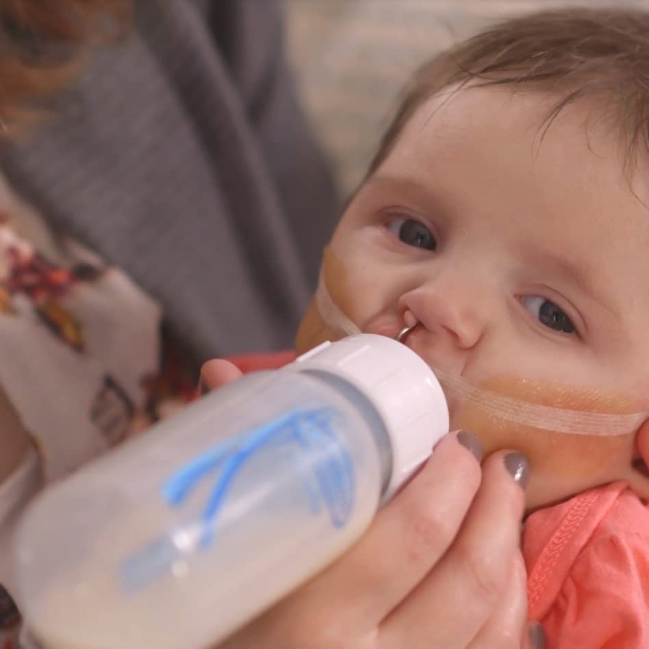 Infant-Paced Feeding Valve from Dr. Brown's system supports controlled feeds