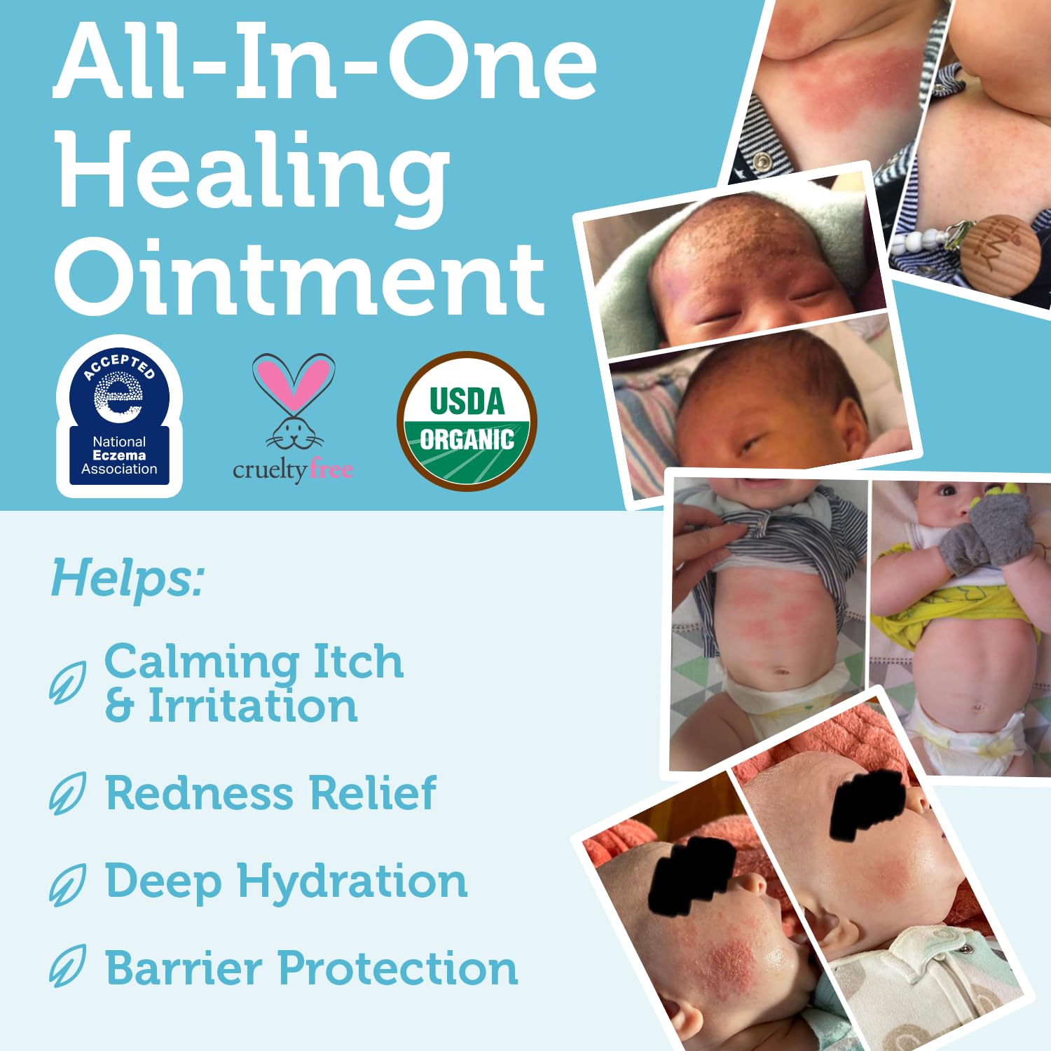Era Organics Healing Ointment rash-relief closeup signals gentle daily care