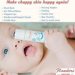 Flanders Healing Stick application on hand delivers immediate moisturization for dry, irritated skin.
