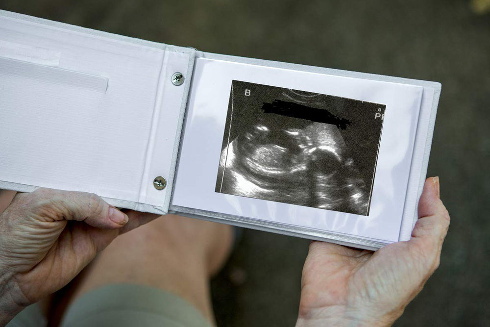 The Grandparent Gift Co ultrasound organizer close-up—sturdy construction for lasting memories.