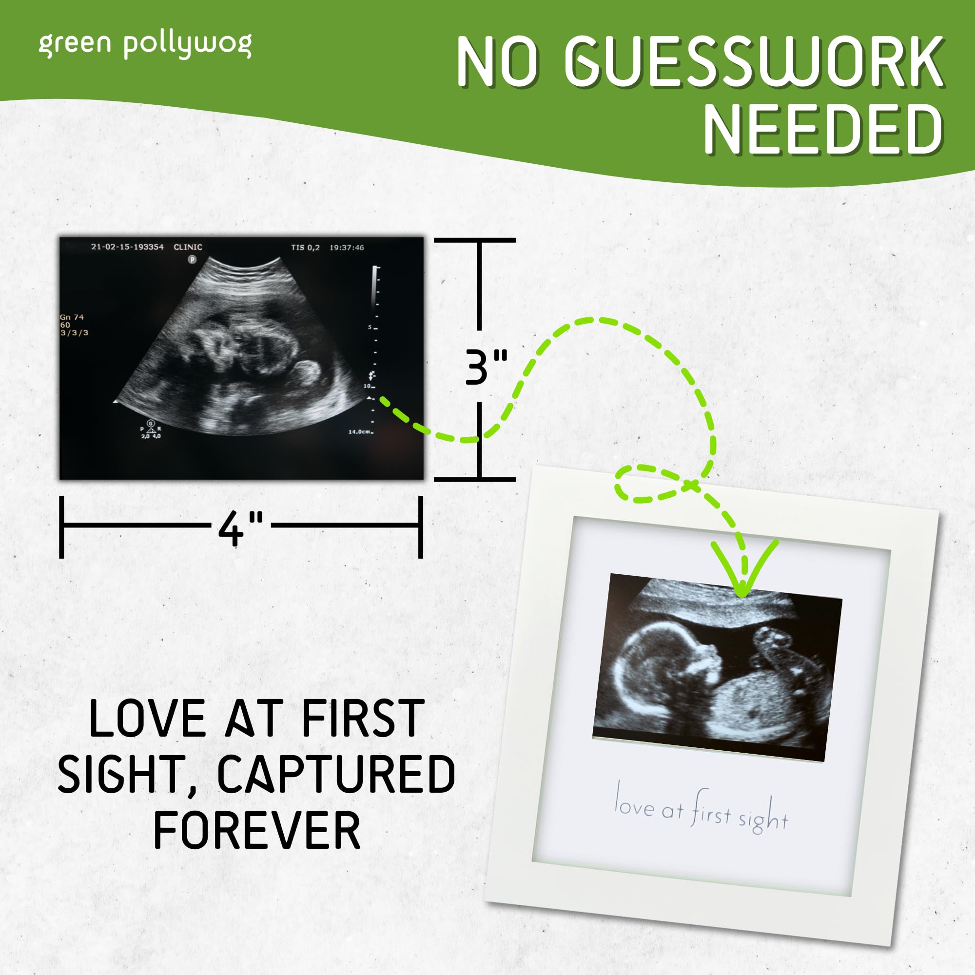 Green Pollywog sonogram frame wall display demonstrates versatile nursery mounting