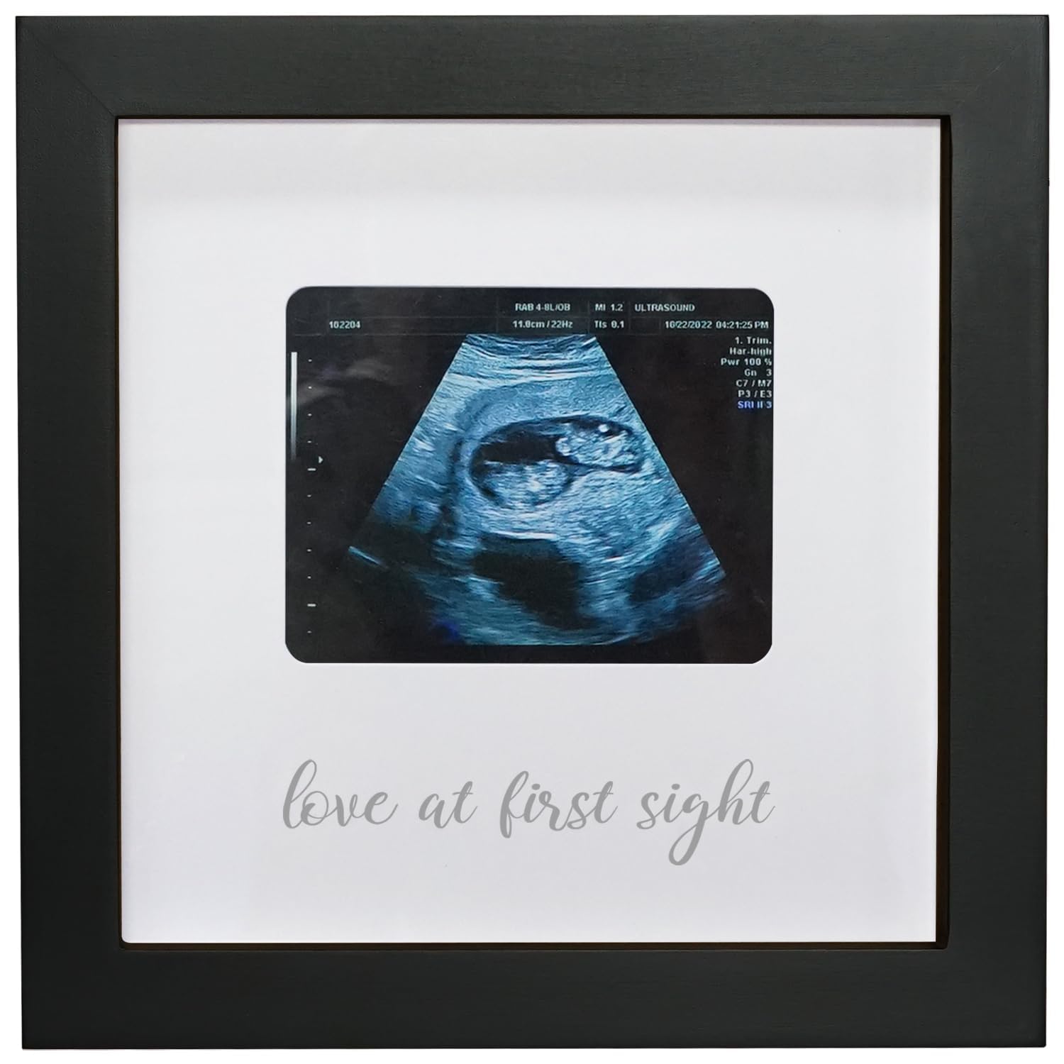 HAMUIERS Love at First Sight frame front-view shows a black wooden ultrasound keepsake.