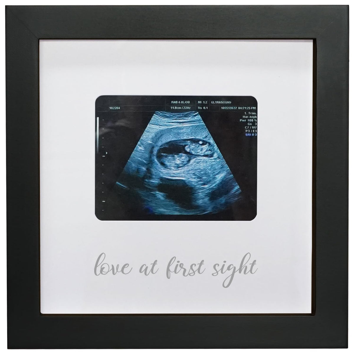 HAMUIERS Love at First Sight frame front-view shows a black wooden ultrasound keepsake.