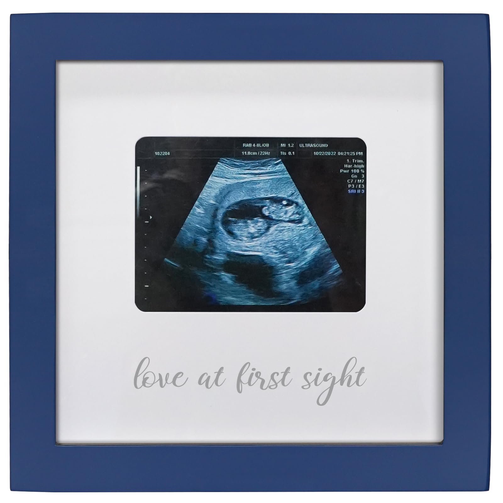 HAMUIERS Love at First Sight frame showcases ultrasound photo for keepsake
