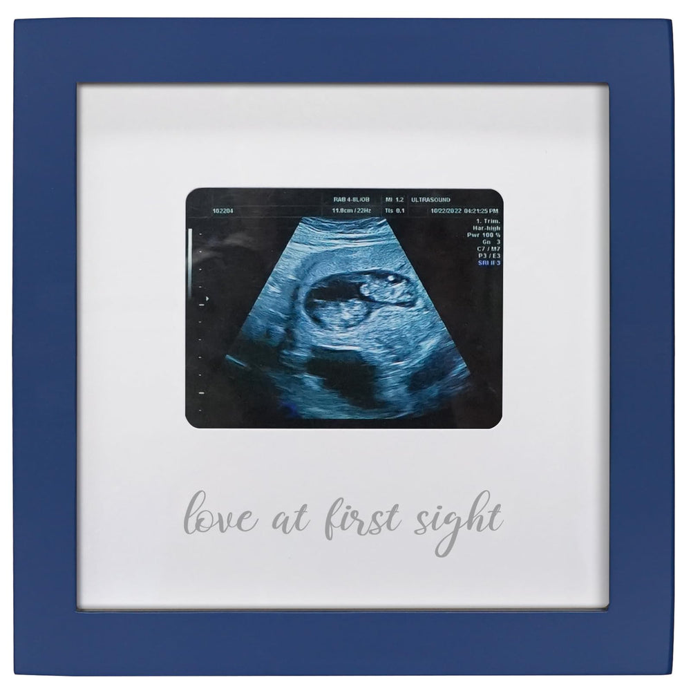 HAMUIERS Love at First Sight frame showcases ultrasound photo for keepsake