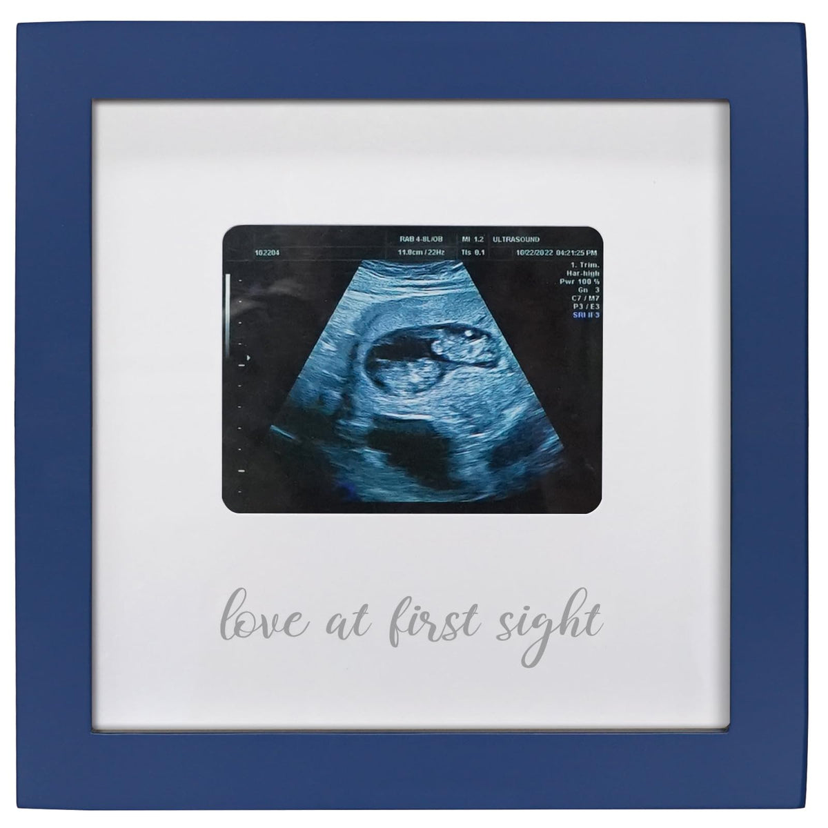 HAMUIERS Love at First Sight frame showcases ultrasound photo for keepsake