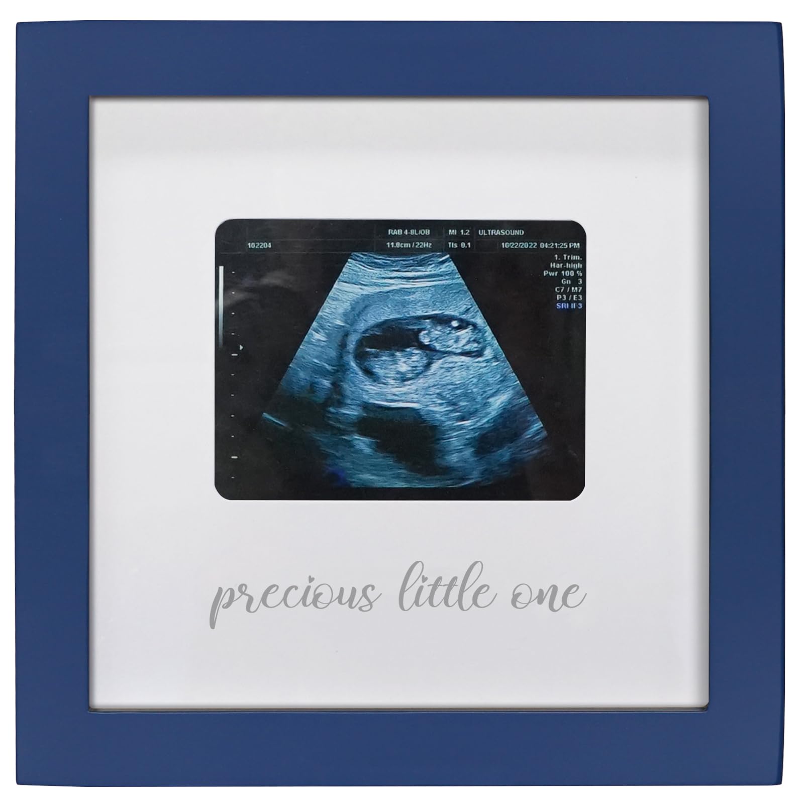 HAMUIERS Sonogram Frame blue wooden nursery decor to display ultrasound photos.