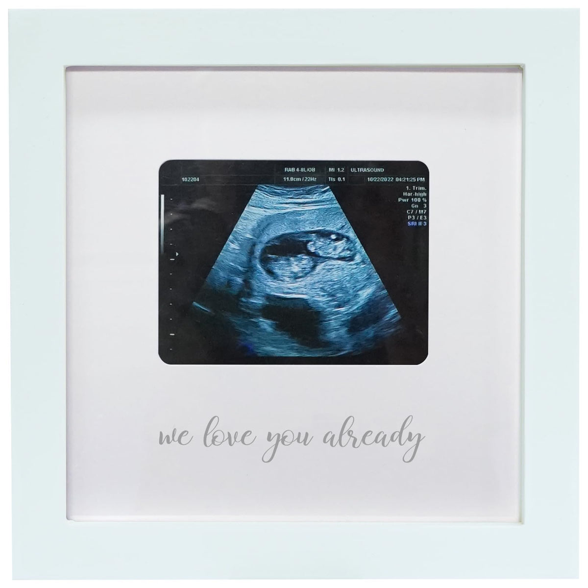 HAMUIERS sonogram picture frame in a nursery decor setting highlights cherished memories.