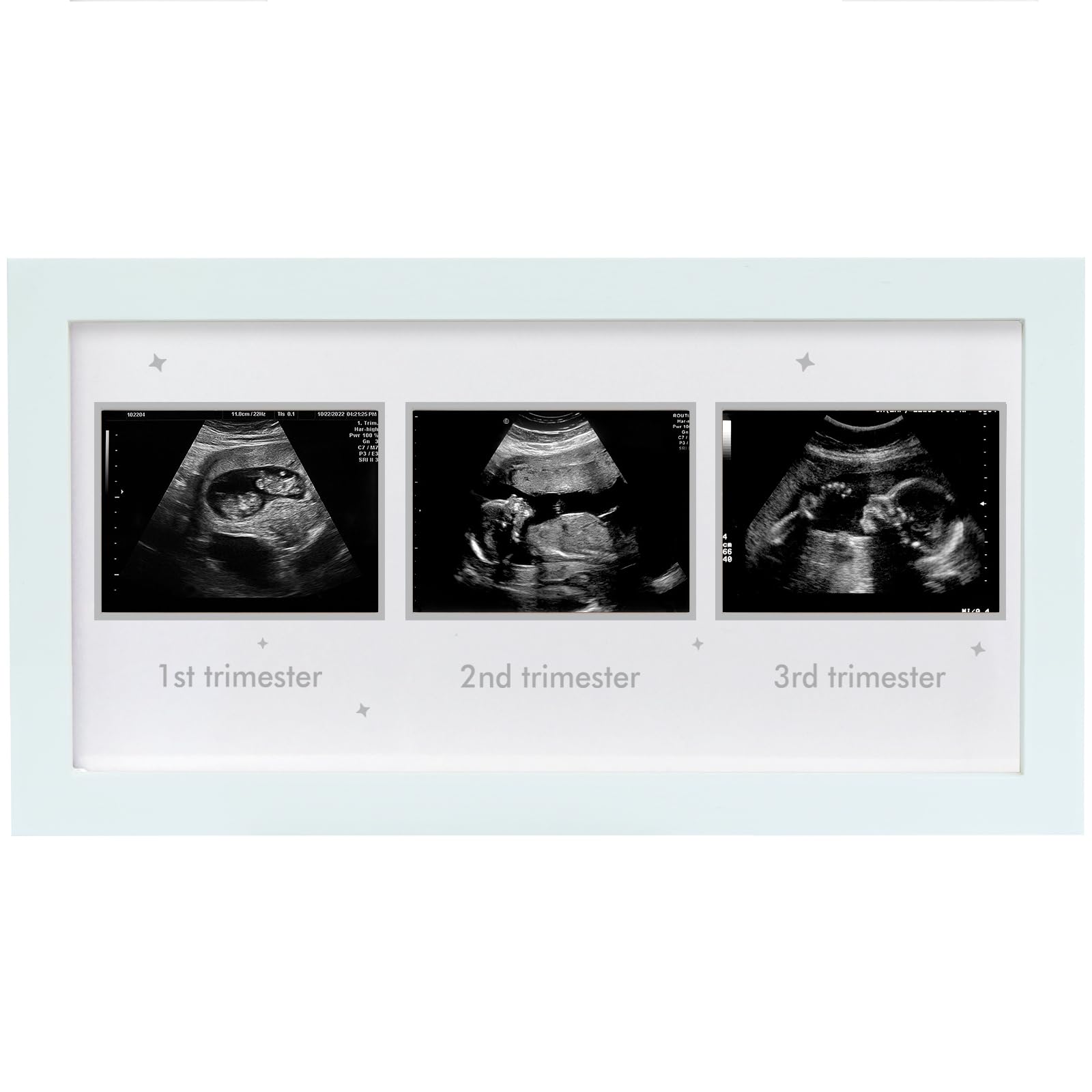 HAMUIERS Ultrasound Frame front view in a bright nursery emphasizing easy memory display.