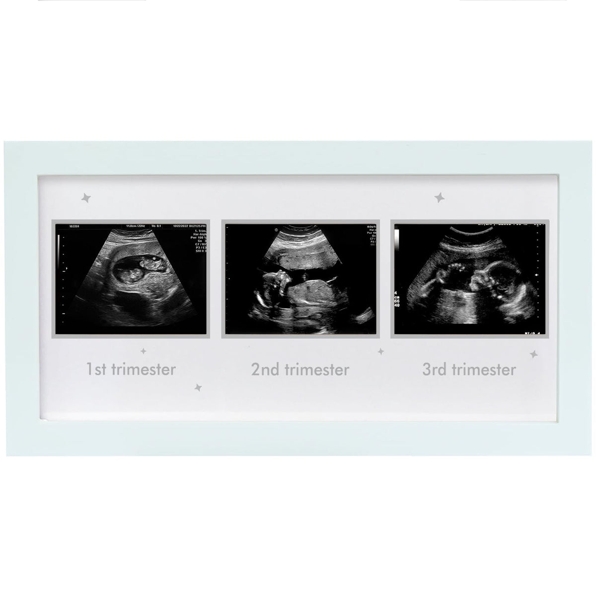 HAMUIERS Ultrasound Frame front view in a bright nursery emphasizing easy memory display.