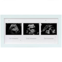 HAMUIERS Ultrasound Frame front view in a bright nursery emphasizing easy memory display.