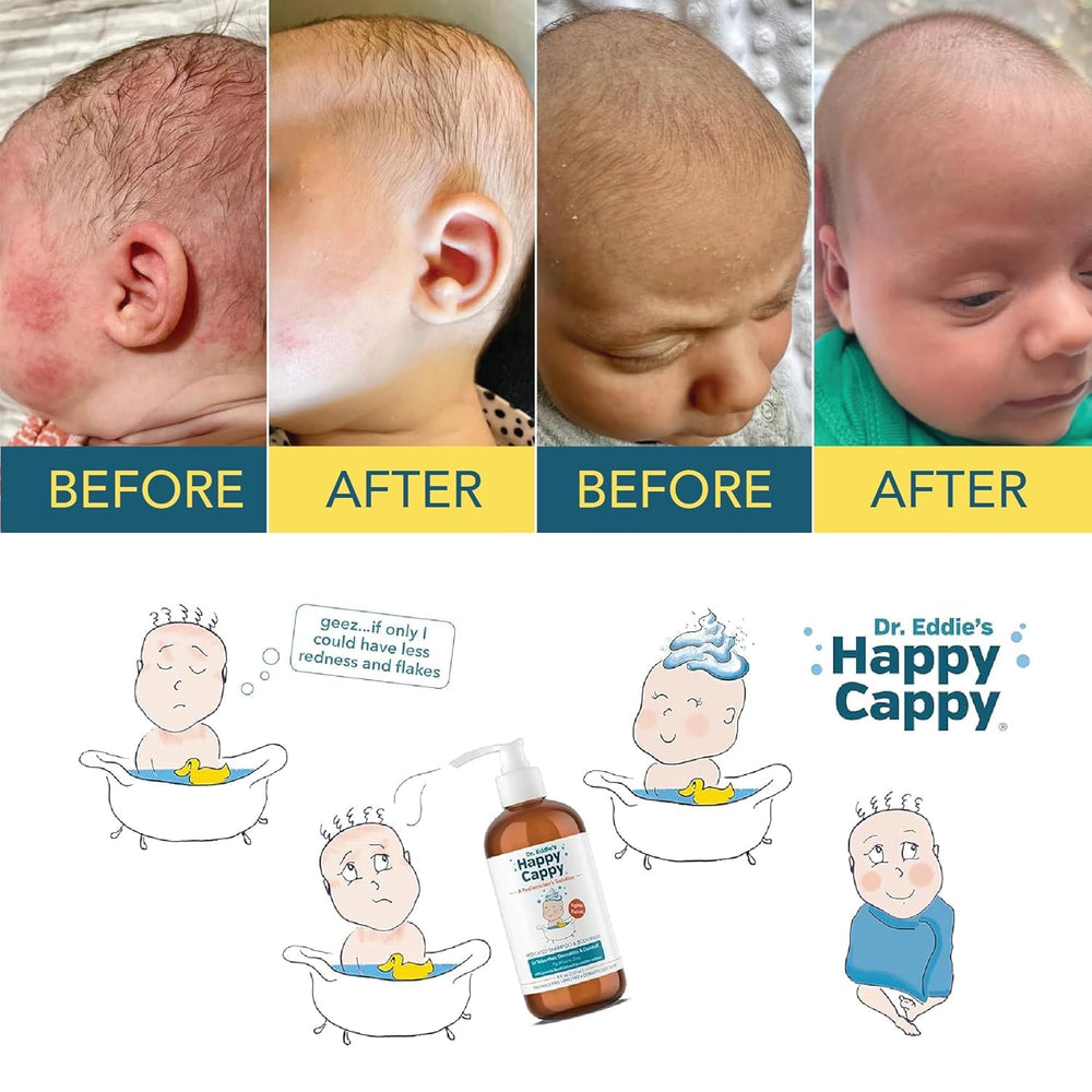 Happy Cappy hands-and-body wash used on infant skin.