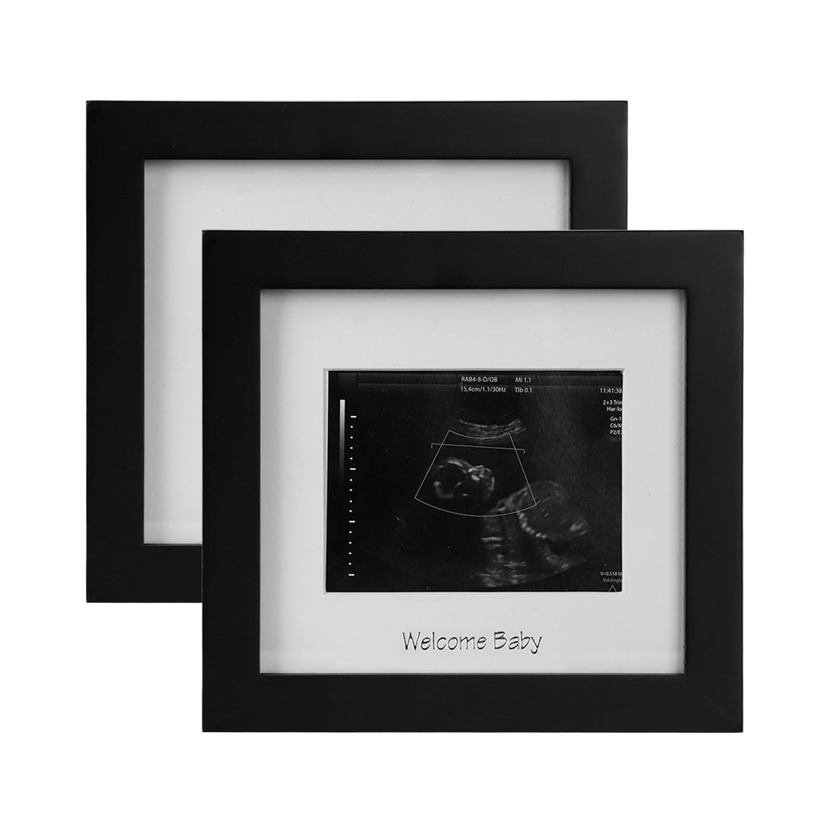 IHEIPYE baby sonogram frame front view two-pack for stylish nursery decor