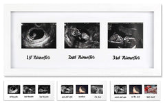 IHEIPYE triple sonogram frame front view highlighting three trimester slots for keepsake photos in nursery decor