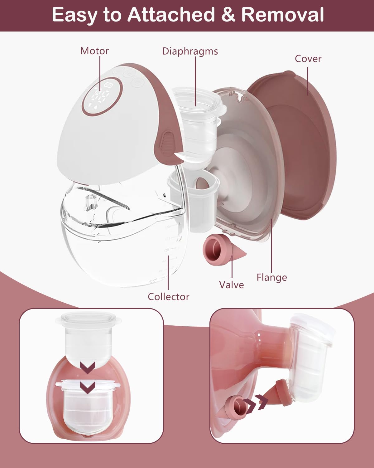 IVARONAL transparent diaphragms kit facilitates quick part identification.