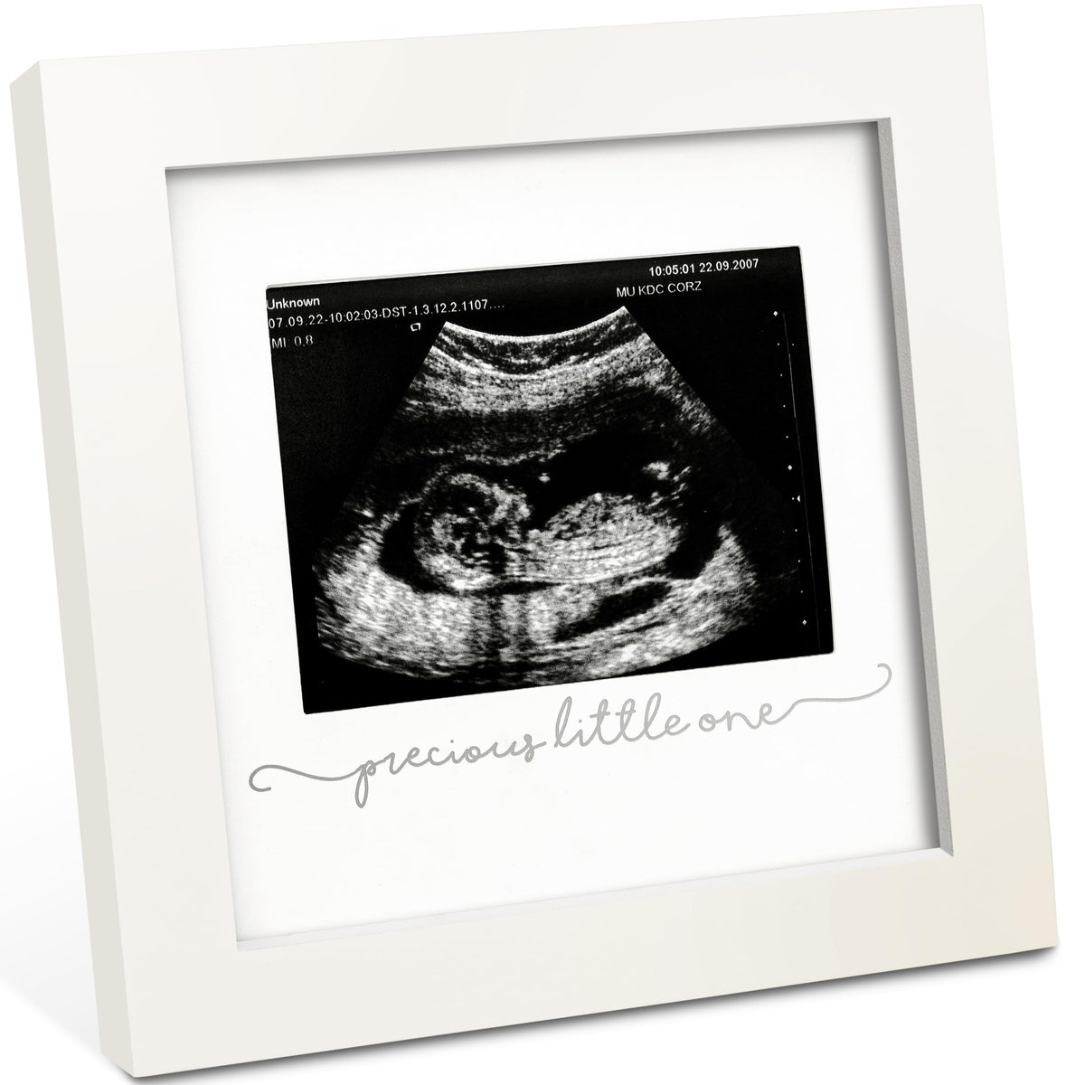 KeaBabies Solo Sonogram Frame Alpine White with glass cover for ultrasound keepsake display