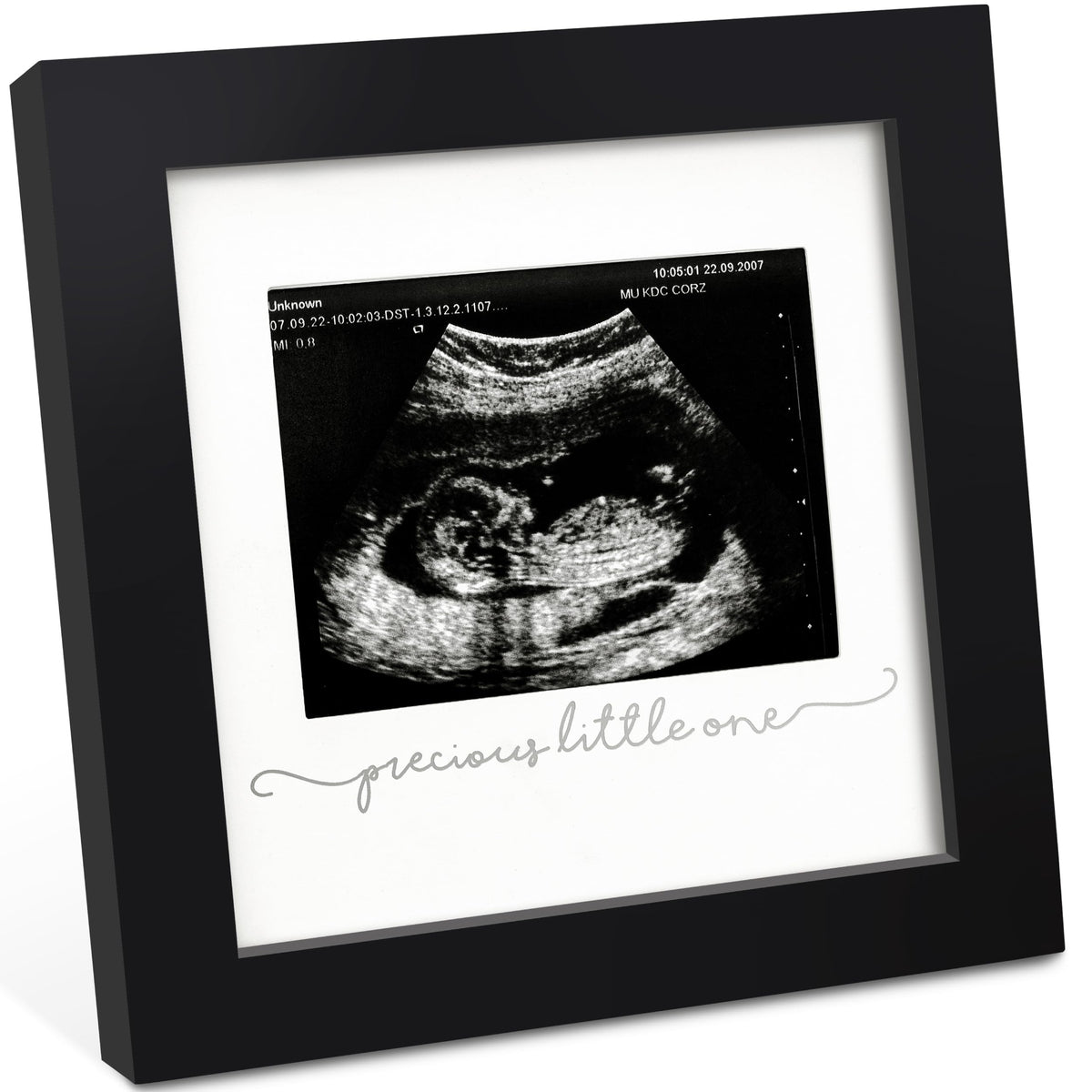 Keababies Solo Sonogram Frame with glass cover, ideal for premium nursery keepsake display.