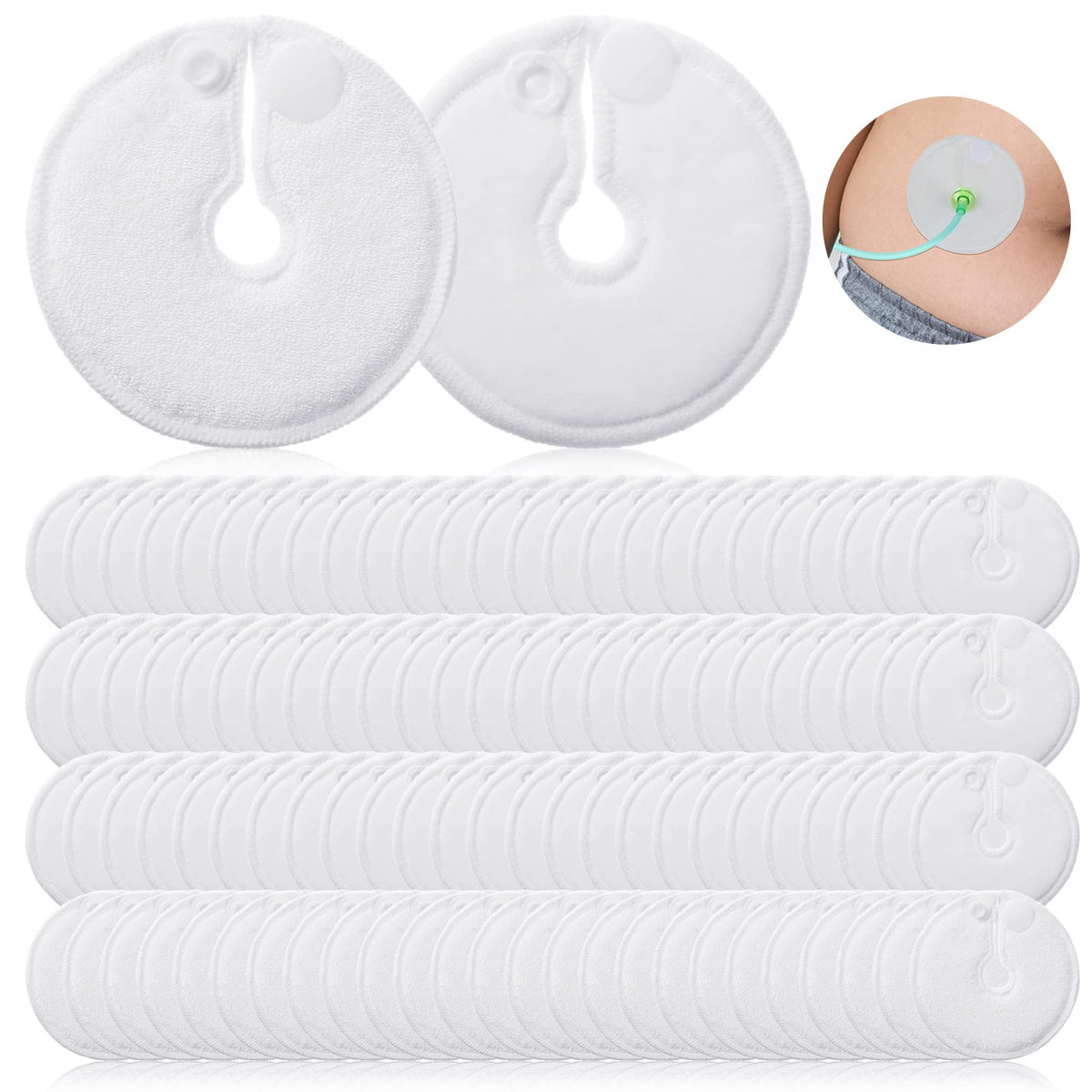 Kingdder 100 pieces G Tube Pads Pack for daily use and gentle protection.