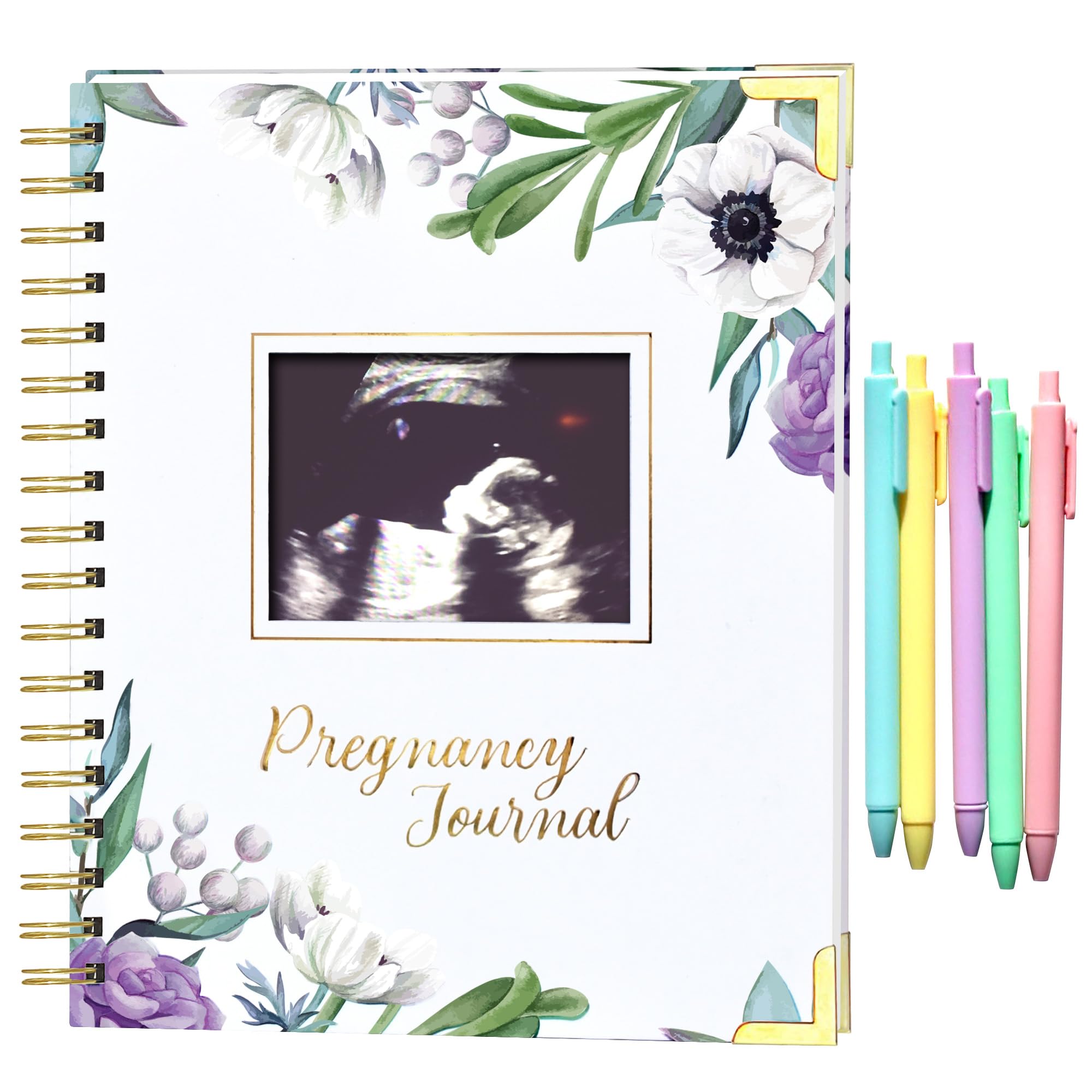 MF&HN STORE Elegant Pregnancy Journal cover—durable keepsake for your motherhood journey.