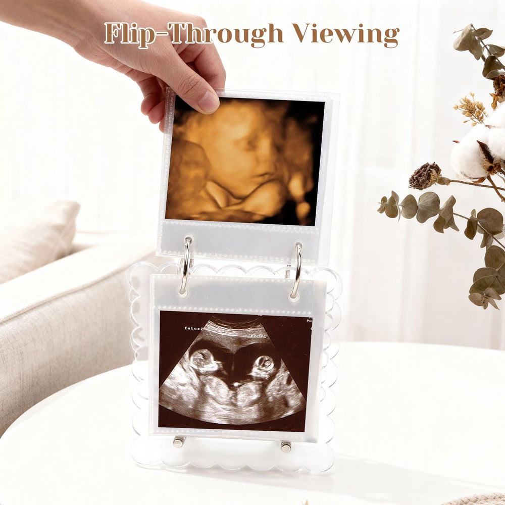 Mlatnod calendar-style ultrasound album enables simple planning of memories