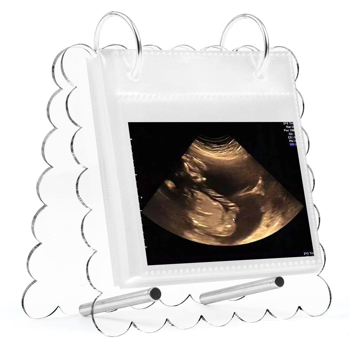 Mlatnod flip ultrasound album with stand for easy bedside viewing