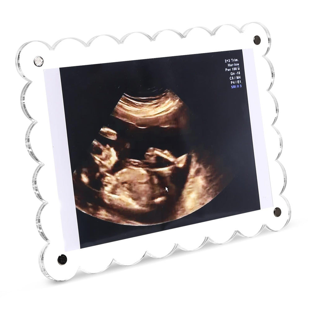 Mlatnod magnetic frame on fridge showcases ultrasound photo for easy swap