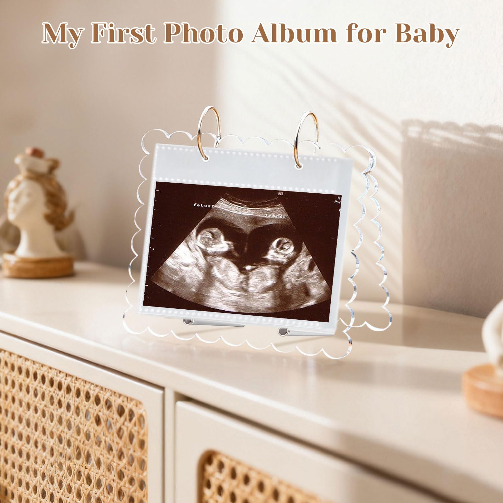 Mlatnod ultrasound album with acrylic scalloped cover adds elegant display