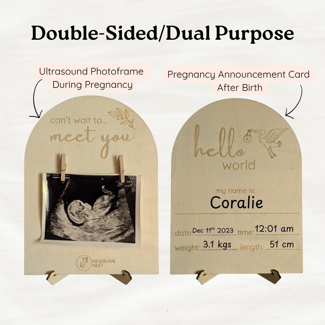 Newborn Nest ultrasound frame closeup pegs shows secure support for your precious sonogram.
