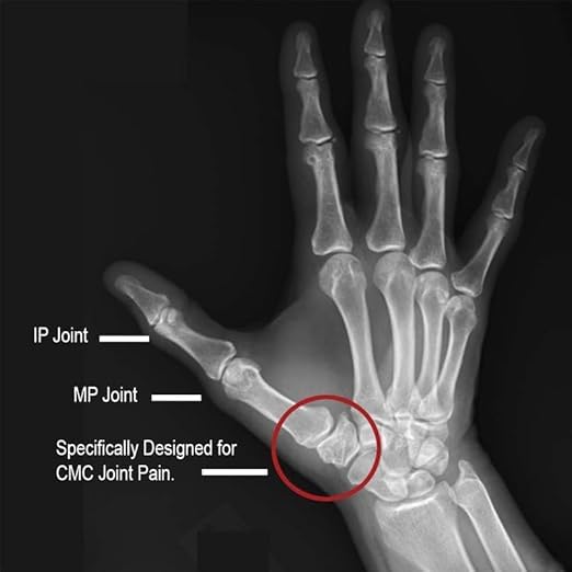 North Coast Medical Comfort Cool CMC Restriction Splint left large packaging image.