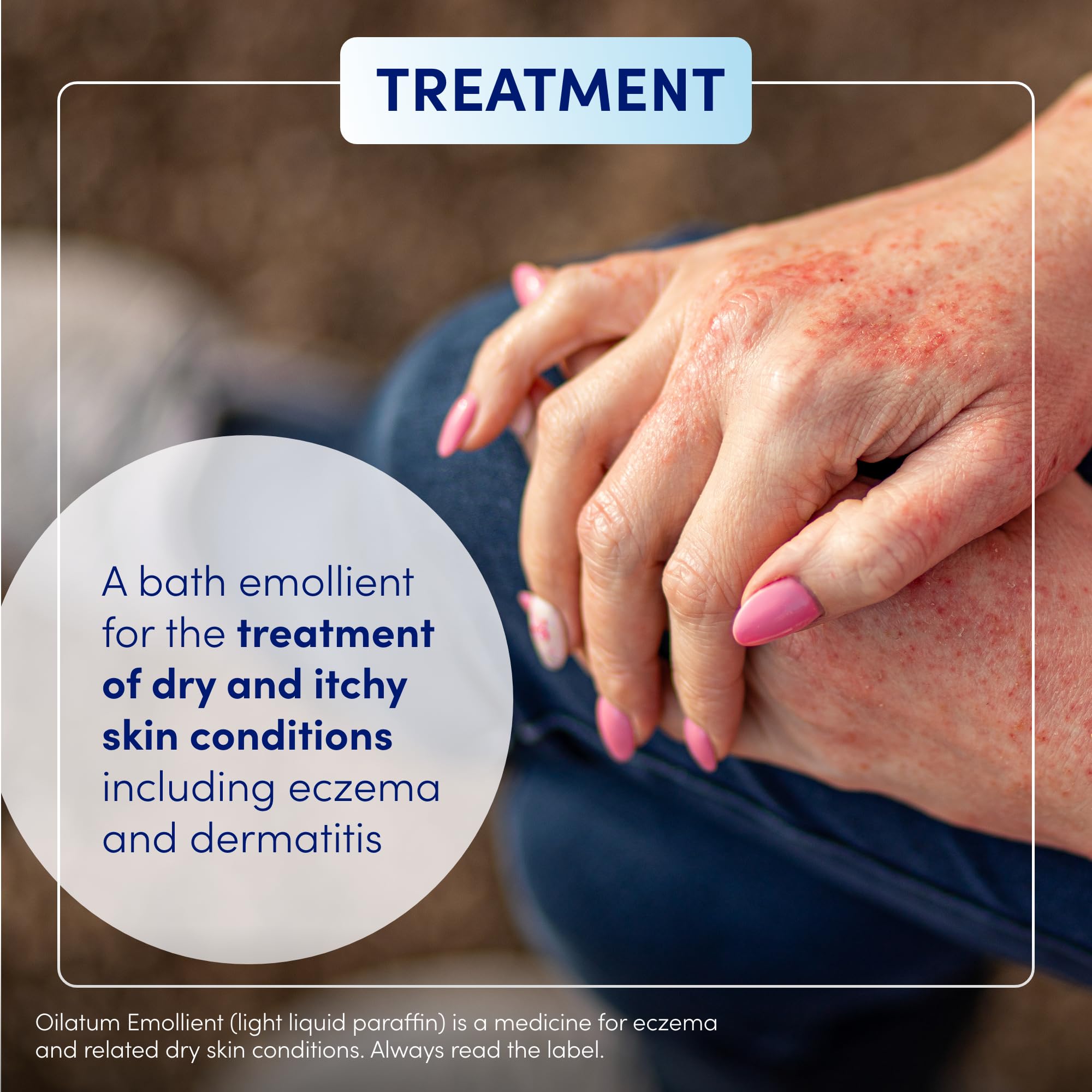 Oilatum Emollient 500ml skin application demonstrates protective layer for softened skin.