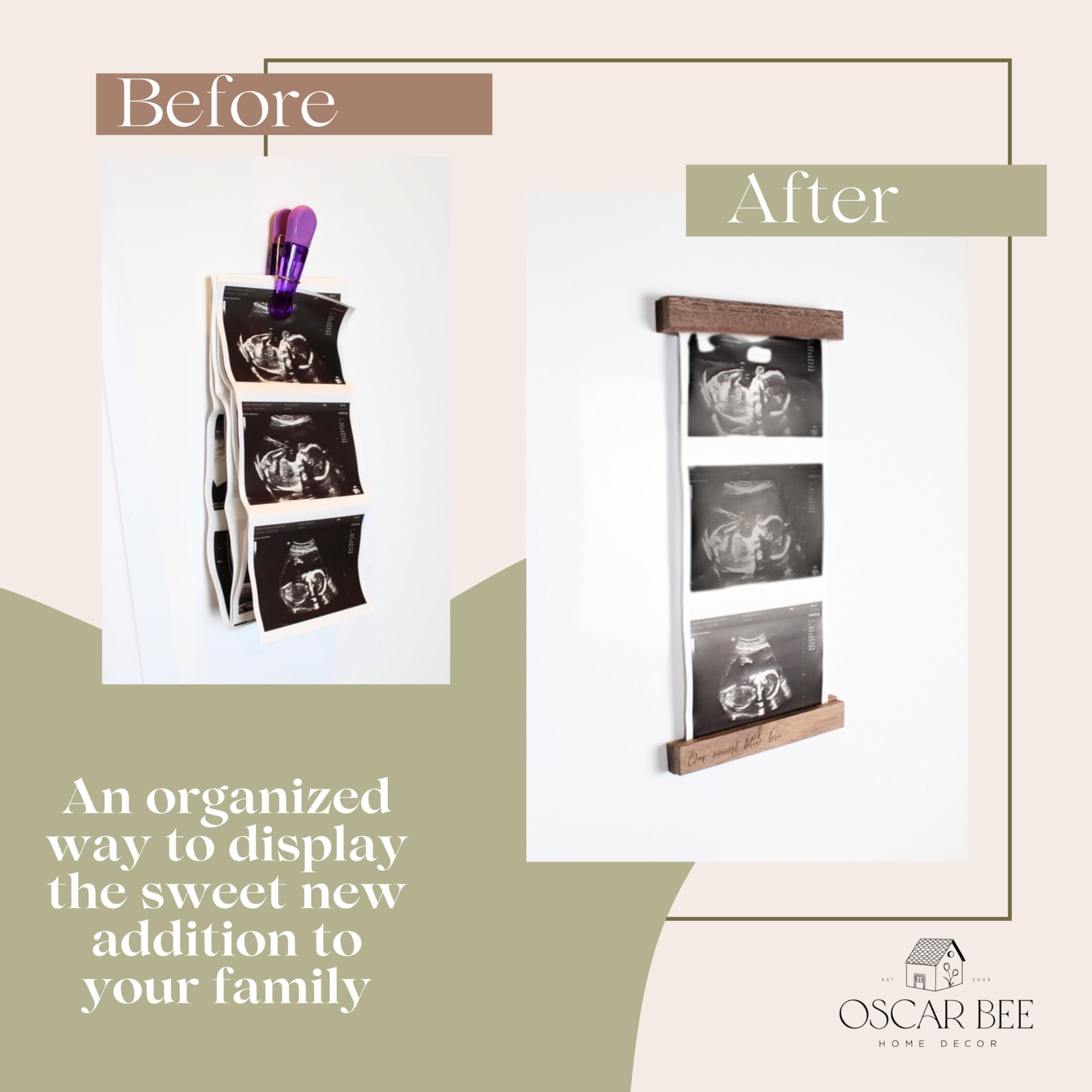 Oscar Bee refrigerator-display frame showcases ultrasound art on kitchen wall.