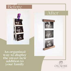 Oscar Bee refrigerator-display frame showcases ultrasound art on kitchen wall.